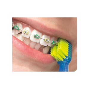 Curaprox Orthodontic Care Kit