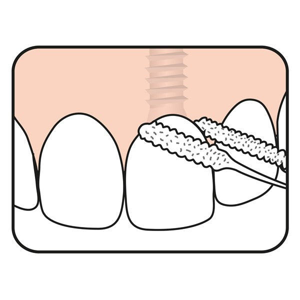 TePe Bridge & Implant Floss, Pack of 30